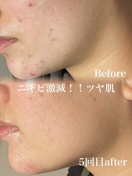 リイル バイ クレビア(REILE by Crebia)/お客様写真