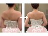 【ブライダル無料相談】肩甲骨見せ背中×小顔ケア！カウンセリングクーポン