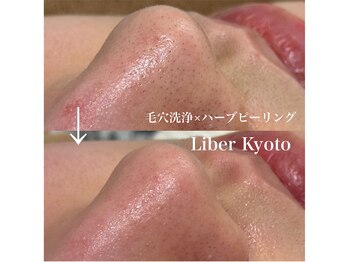 リベルキョウト 京都駅前店(Liber Kyoto)/毛穴レス艶肌コース