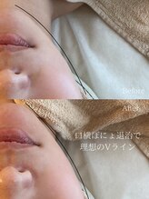 サロン ド ビビ(salon de bibi*)/お顔の余白をなくします