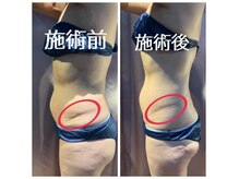 プライマルバランス(PRIMAL BALANCE)の雰囲気(ラジオ波/キャビテーション/EMS/吸引で脂肪撃退!!)