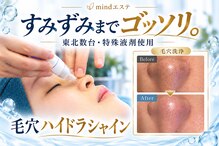 マインドエステ 仙台店(mindエステ)