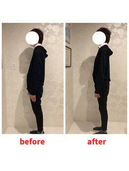 ナオル整体 福岡香椎院(NAORU整体)/20代男性施術事例【姿勢改善】