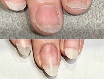 グレースレディ 神戸北店/