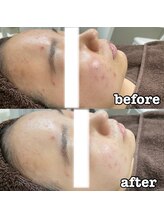 ディアー 原宿(Diar)/お客様ビフォーアフター(症例)