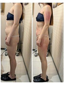 ローズ(ROSE)/贅肉撃退ならこれ