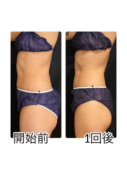 こねこのシッポ 虎ノ門/1回でも浮腫みがシュッ!