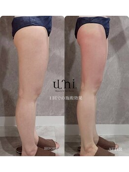 ユニ(uni.)/美脚ケア