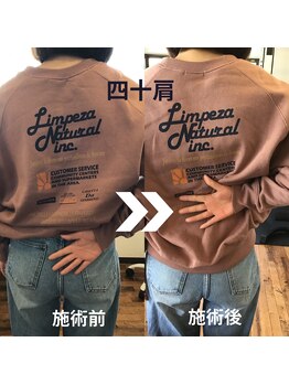 からだサロン サニー 堺東(SUNNY)/肩の痛み