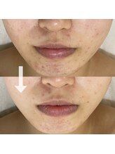 シェノン 赤坂大濠店/