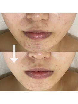 シェノン 赤坂大濠店/