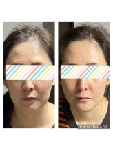 月海/一回でビックリの変化！