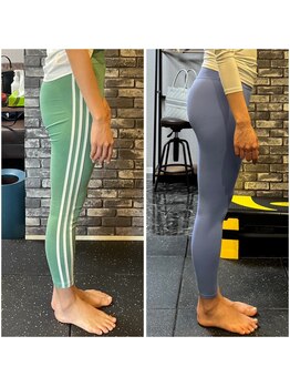 レガリス(REGALIS)/before/after ヒップアップ