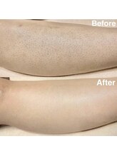 ラティア(Ratia)/