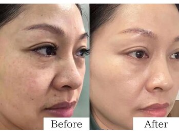 ミューズファクトリー(Muse factory)/ノーファンデ肌は実現できる！