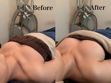 ジェイオー(J.O)/バストアップコルギ/小顔コルギ