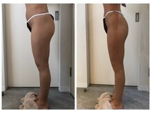 エイシスグロウ(asis glow.)/効果写真