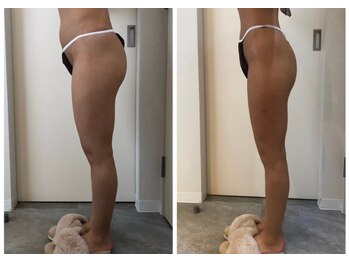 エイシスグロウ(asis glow.)/効果写真