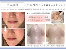 フレイヤ(FREYA)