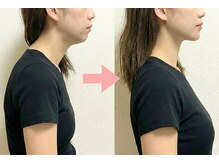 ニュートラル 渋谷店(NEUTRAL)/肩こり、巻き肩対策矯正