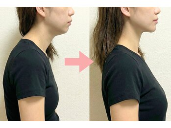 ニュートラル 渋谷店(NEUTRAL)/肩こり、巻き肩対策矯正