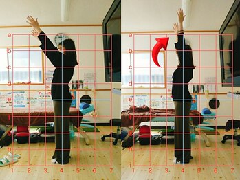 サプライズ整体院/20代ママさんの肩こり初回結果