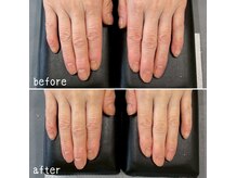 ネイルズ アヴァンティ(Nails Avanti)の雰囲気（乾燥した指先や手肌、指関節が気になる方にはハンドエステが◎）
