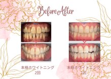 コトリト(Cotorito)