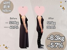 ひなた整骨院/４０代女性149cm