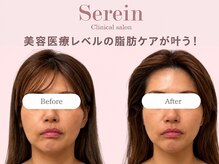 スレーン 上本町(Serein)