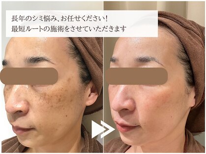 レイテノール 藤沢店の写真