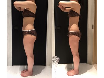 リボディ 表参道(An re Body)/before→after