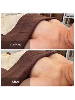 サロン ド ミモザ(Salon de Mimosa)/バストアップお試し