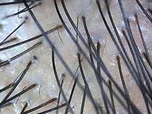 スカルプラボ(Scalp Lab)/N様新毛チェック