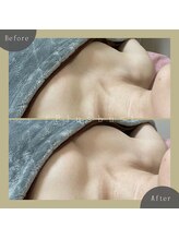 プラス バスト(+Plusバスト)/お客様BeforeAfterお写真