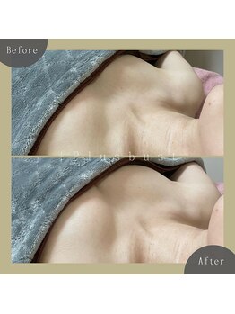 プラス バスト(+Plusバスト)/お客様BeforeAfterお写真