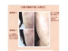 ターリア(THALIA)