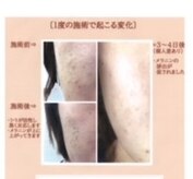 ターリア(THALIA)