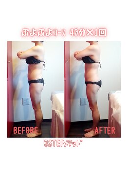 ビューティサロン キヨの部屋(beauty salon)/【ぷよぷよ浮腫みさんコース】