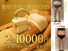 ボディキュア グランド(Body cure Grand)の雰囲気（大好評の脂肪冷却！初回限定キャンペーン継続！）