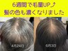 初回【re:genexell (リジェネクセル)】初回カウンセリング＆施術体験 ¥9800