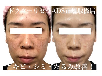 ローズフィールド(Rosefield)の写真