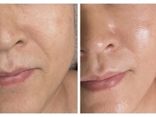 ムク(MUKU 無垢)/セラピール