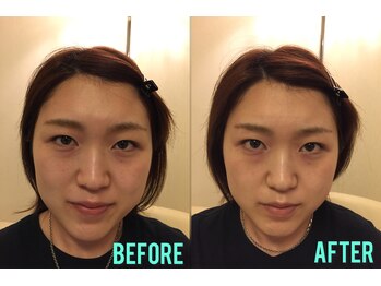 エムドゥービー(Mde`B)/小顔矯正。キュアフェイス