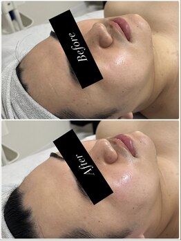 ザセイム(the same)/男性のご予約も受け付けてます！