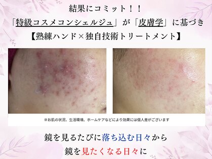 ダーウィン(Darwin)の写真