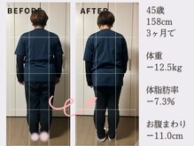 香林(KARIN)/ビフォーアフター