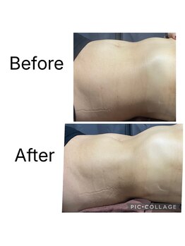 ビマナ 海浜幕張店 夢の樹(NU美Mana)/Manaセラピー(お腹)