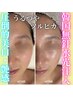 【韓国肌管理のお試しに☆】美白/毛穴レス/うるつや水光肌管理シェービング