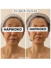 ハピココ(HAPIKOKO)/フォースカッター
